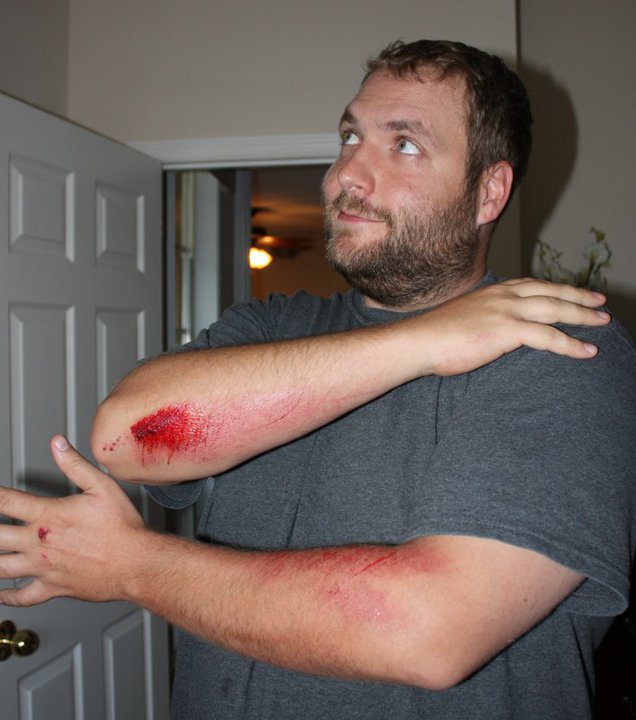 Ouch! Ouch!